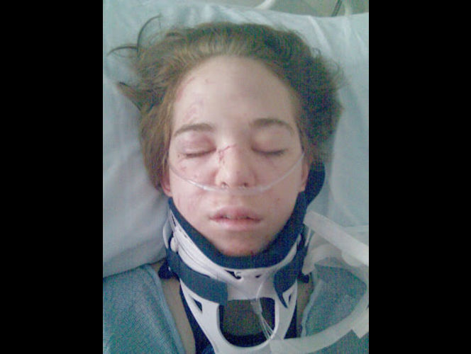 Kari in Hospital after She was hit
